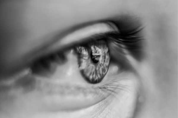 Ameliyatsız Badem Göz Estetiği 4