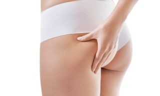 Kalçadan Yağ Aldırma ( Liposuction )