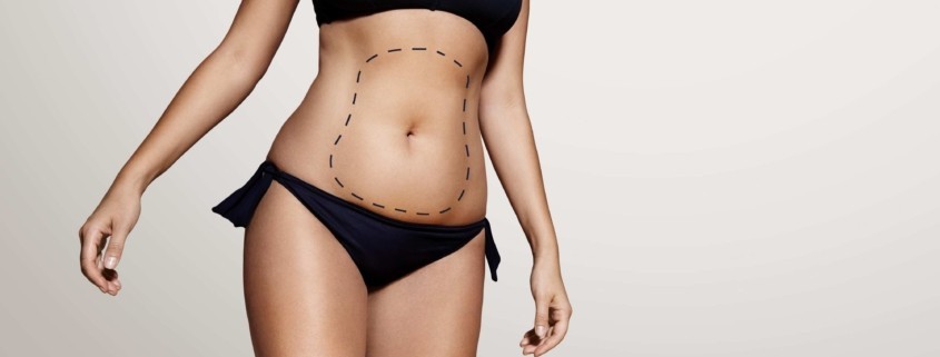 Liposuction Korsesi Ne Kadar Süre Kullanılır?