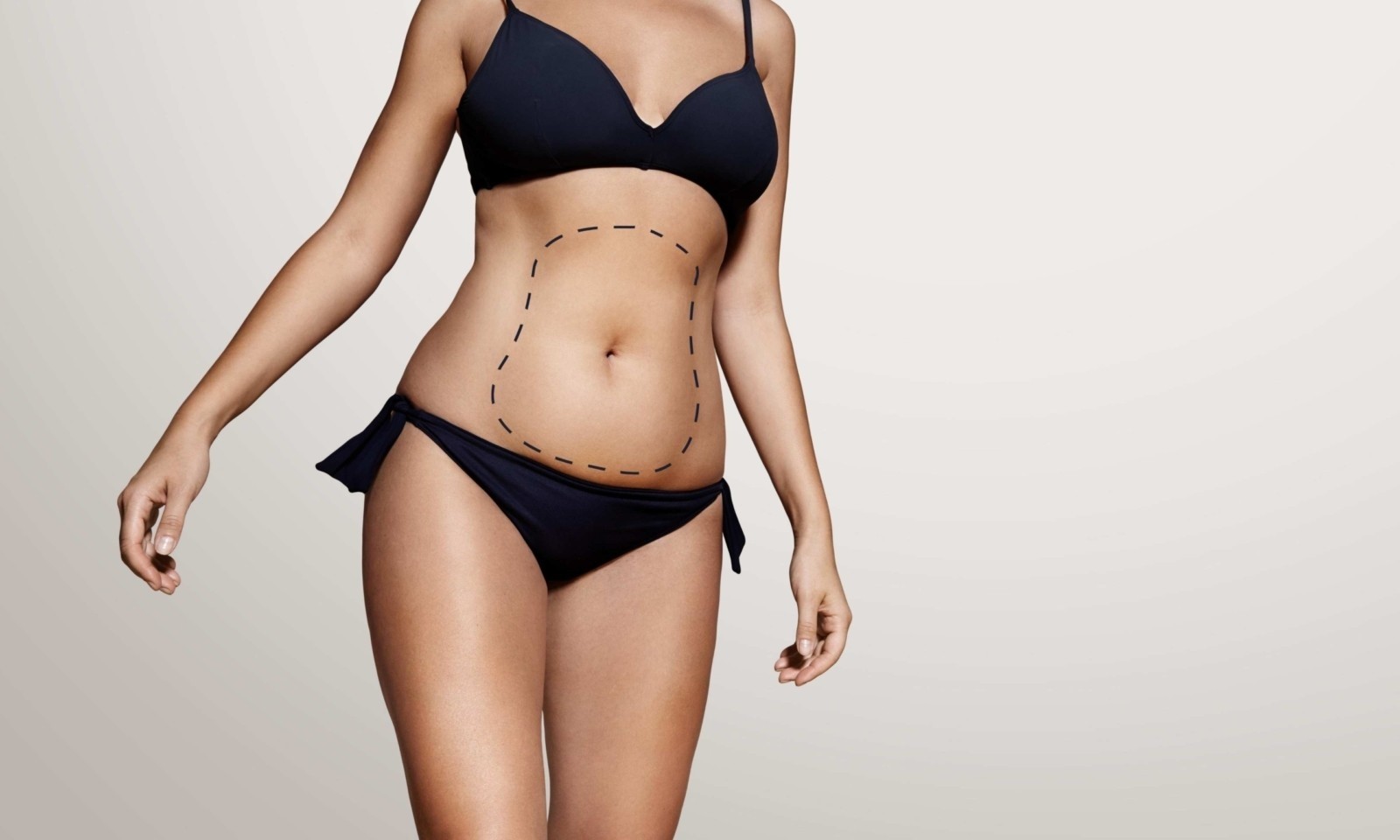 Liposuction Korsesi Ne Kadar Süre Kullanılır?