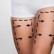Bacak Yağı Aldırma Ameliyatı ( Liposuction )