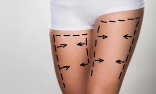 Bacak Yağı Aldırma Ameliyatı ( Liposuction )