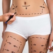 Liposuction Zararları Var Mıdır?
