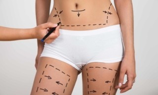 Liposuction Zararları Var Mıdır?