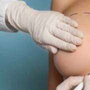 Breast Reduction in Turkey
