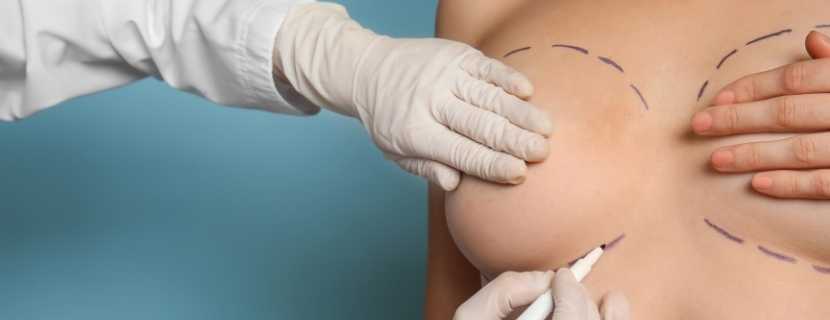 Breast Reduction in Turkey