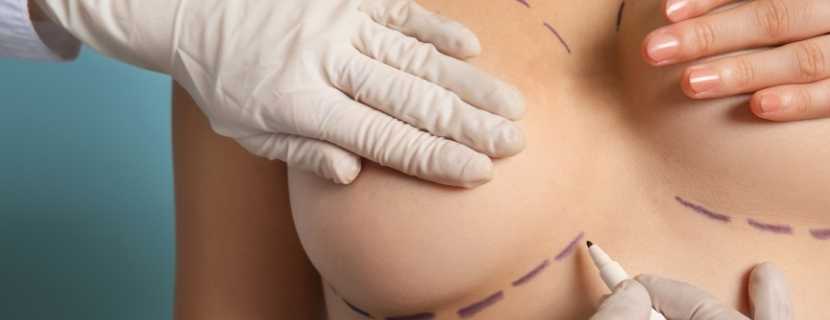 Breast Lift (with or without implants) in Turkey