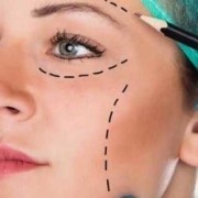 FaceLift Surgery in Turkey