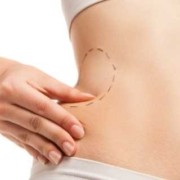 Liposuction Sonuçları Ne Zaman Belli Olur?