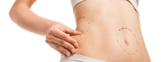 Liposuction Sonuçları Ne Zaman Belli Olur?