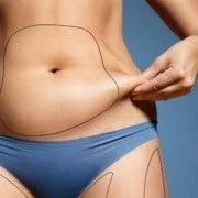 Vaser Liposuction Etkisi Kalıcı Mıdır?