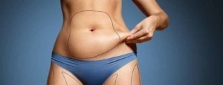 Vaser Liposuction Etkisi Kalıcı Mıdır?