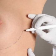 Breast Reduction Surgery Average Cost abroad