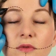 The Average Cost of Face-lift Procedure Abroad  